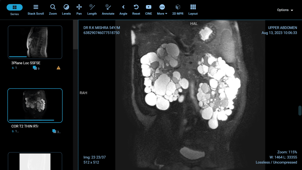 laparoscopic blog 2