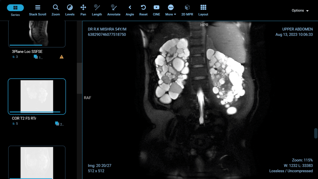 laparoscopic blog 4