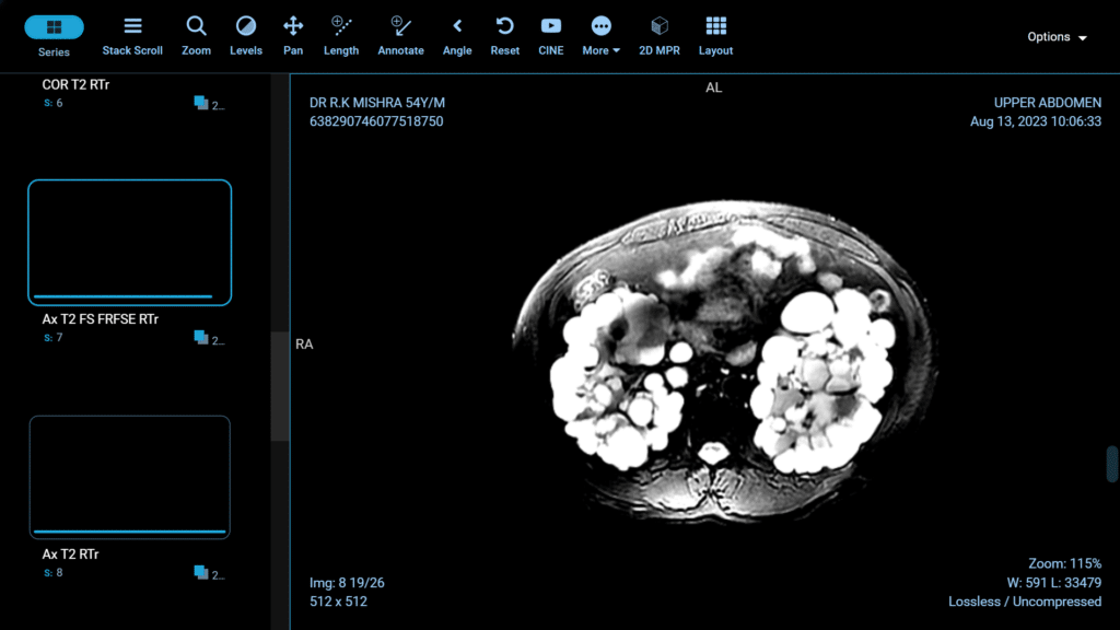 laparoscopic blog 6