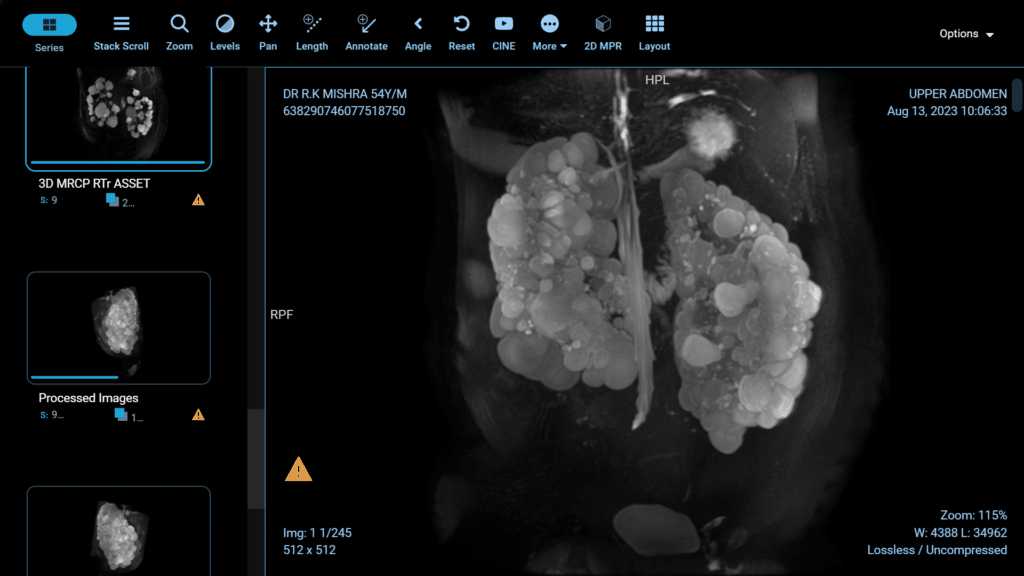 laparoscopic blog 8